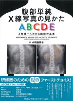 腹部単純X線写真の見かたABCDE：２枚並べてわかる読影の基本の書影