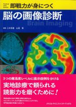 即戦力が身につく 脳の画像診断の書影