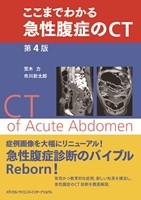 ここまでわかる急性腹症のCT　第4版 の書影