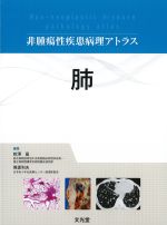 (非腫瘍性疾患病理アトラス)肺の書影