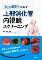 リスク層別化に基づく 上部消化管内視鏡スクリーニングの書影