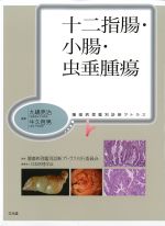 (腫瘍病理鑑別診断アトラス)十二指腸・小腸・虫垂腫瘍の書影