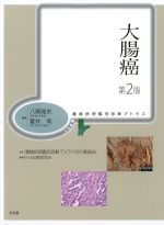 (腫瘍病理鑑別診断アトラス)大腸癌　第2版の書影