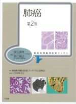 (腫瘍病理鑑別診断アトラス)肺癌　第2版の書影