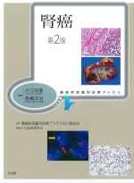 (腫瘍病理鑑別診断アトラス)腎癌　第2版の書影