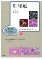 (腫瘍病理鑑別診断アトラス)脳腫瘍　第2版の書影
