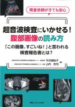 超音波検査にいかせる！ 腹部画像の読み方：「この画像、すごいね！」と言われる検査報告書とは？の書影