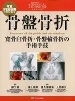 (整形外科SURGICAL TECHNIQUE BOOKS 9)骨盤骨折：寛骨臼骨折・骨盤輪骨折の手術手技の書影
