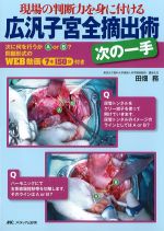 広汎子宮全摘出術次の一手　現場の判断力を身に付けるの書影