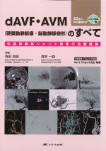 dAVF・AVM(硬膜動静脈瘻・脳動静脈奇形)のすべて：中枢神経系シャント疾患の治療戦略/22本のWEB動画付きの書影