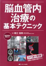 脳血管内治療の基本テクニック：コマ送り解説で知識と技術が結びつくの書影
