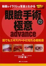 動画＆イラスト＆写真でわかる眼瞼手術の極意advance：誰でもエキスパートになれる戦略書の書影