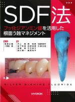 SDF法：フッ化ジアンミン銀を活用した根面う蝕マネジメントの書影