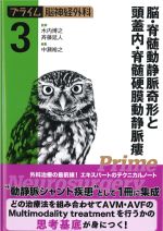 (プライム脳神経外科3)脳・脊髄動静脈奇形と頭蓋内・脊髄硬膜動静脈瘻の書影