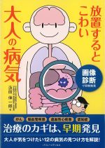 画像診断で早期発見　放置するとこわい大人の病気の書影