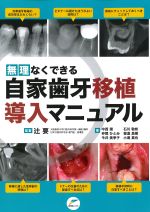 無理なくできる 自家歯牙移植導入マニュアルの書影