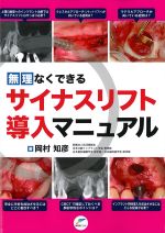 無理なくできるサイナスリフト導入マニュアルの書影