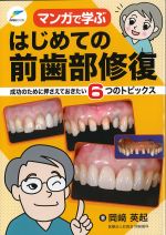 マンガで学ぶはじめての前歯部修復：成功のために押さえておきたい6つのトピックスの書影