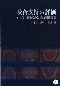 咬合支持の評価：インプラント時代の包括的補綴設計の書影
