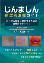 じんましん病型別治療ガイド：あらゆる場面に対応するための実戦的テクニックの書影